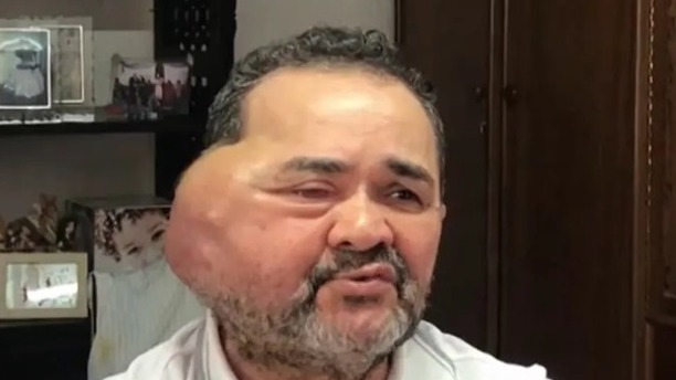 José Nilton vive preocupado com o encaminhamento da sua cirurgia
