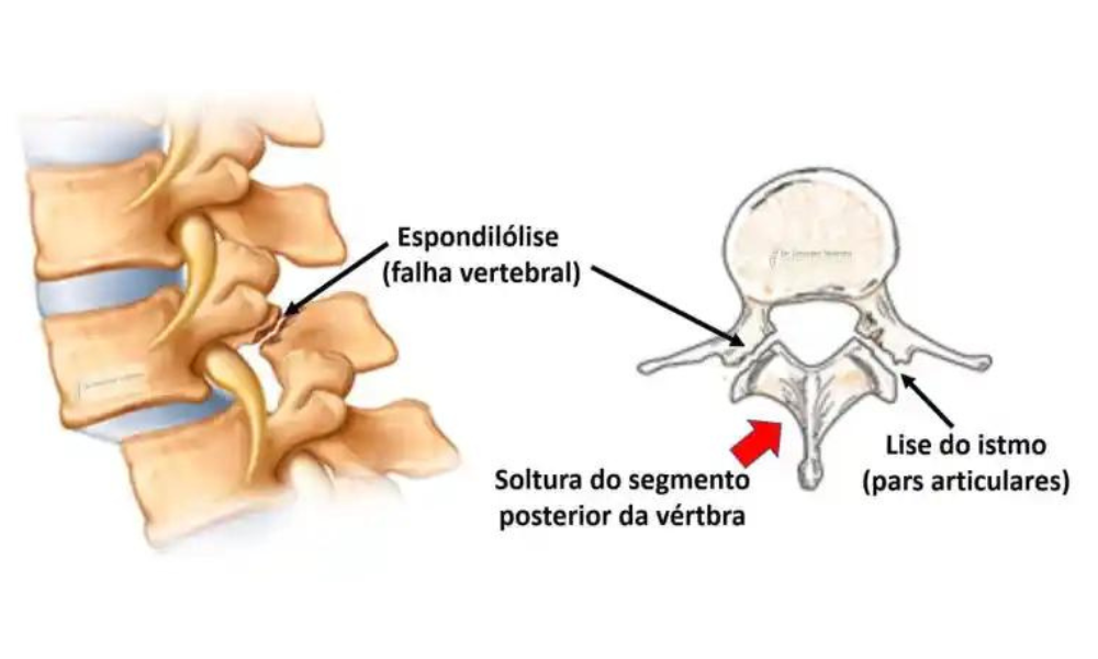 Ilustração sobre 