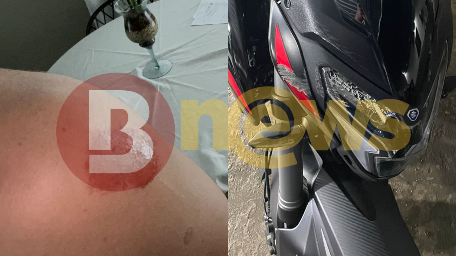 O acidente gerou danos fisicos na moto e no veiculo do condutor / Foto: Acervo pessoal 