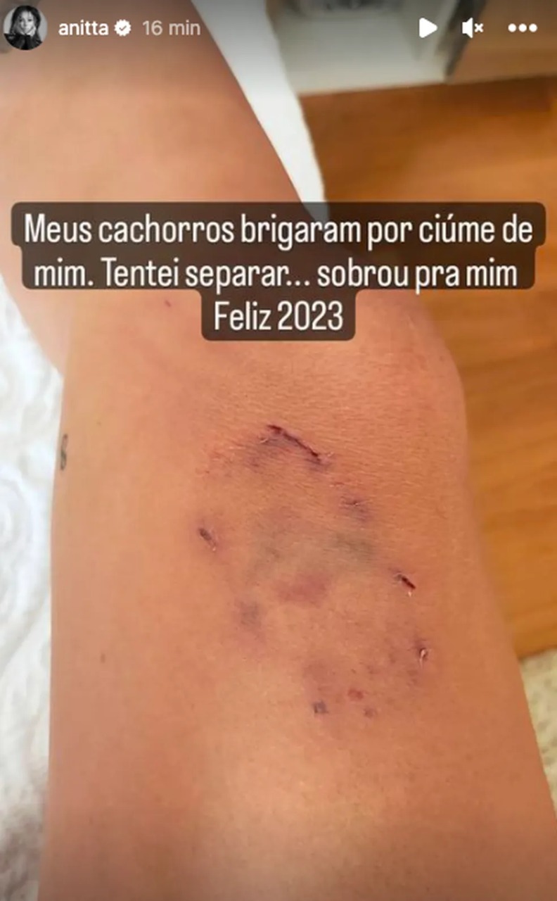 anitta