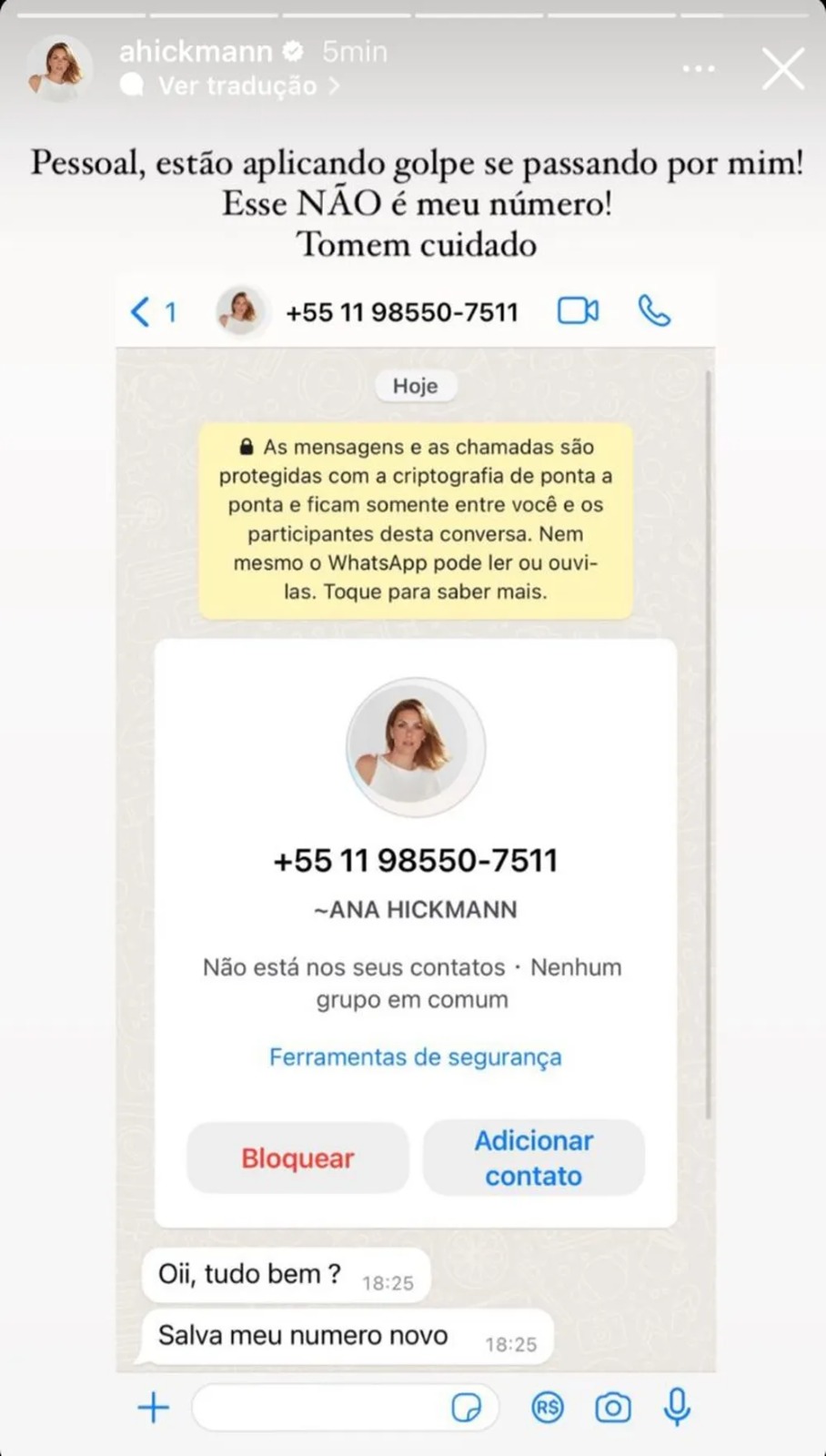 ana