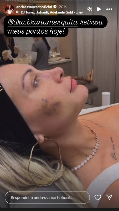 urach