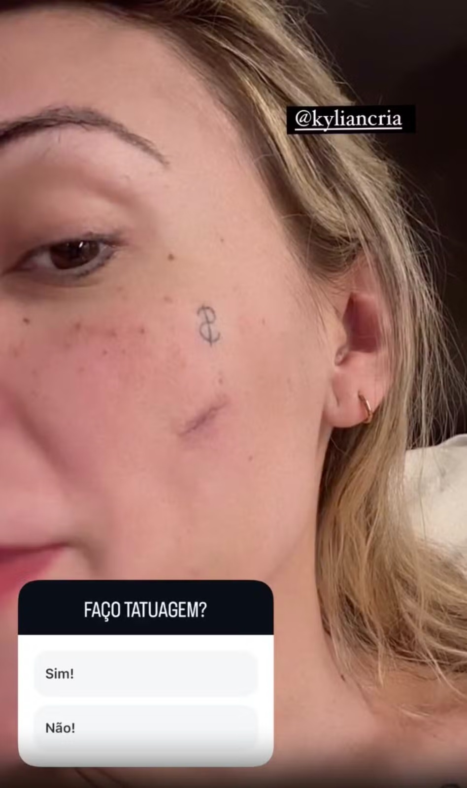 urach