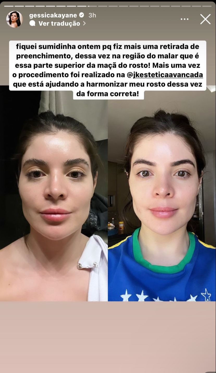 Gkay tira procedimentos 