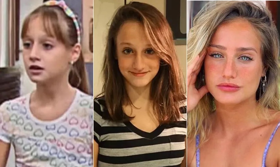  Veja quais procedimentos estéticos brothers fizeram antes do reality