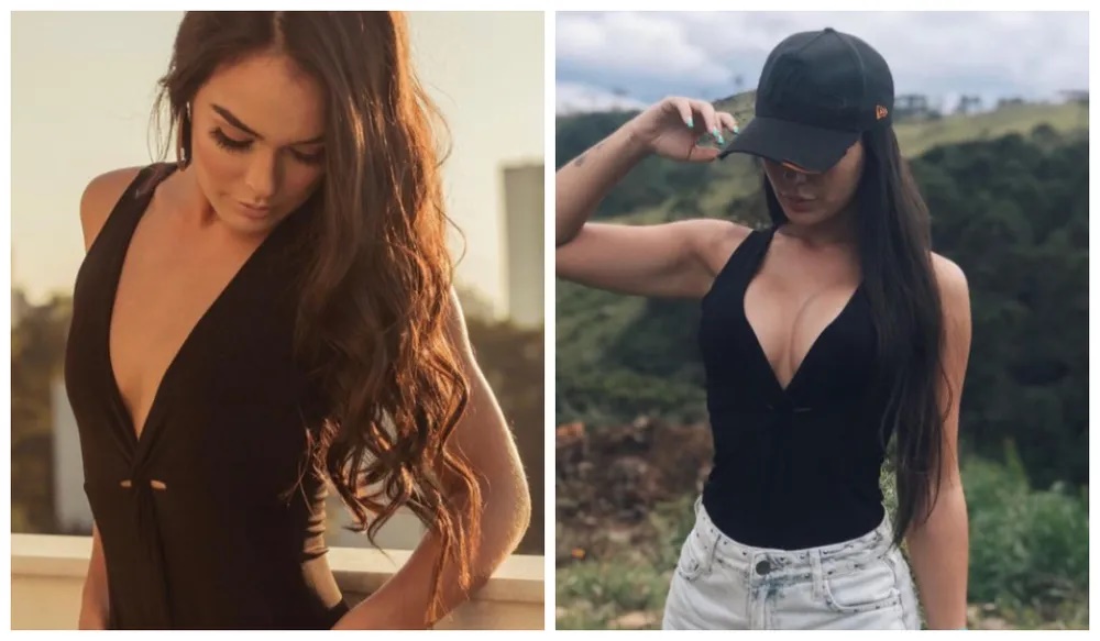 procedimentos estéticos brothers fizeram antes do reality