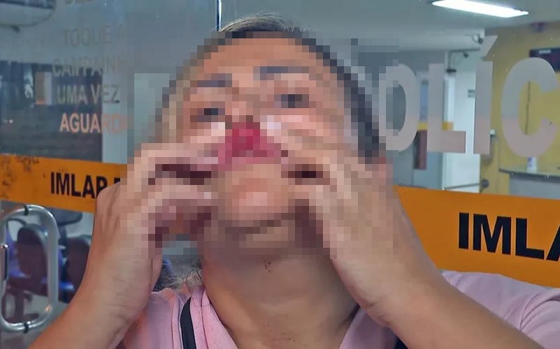 A vítima foi acertada com um soco na boca. Foto: Reprodução/TV Globo