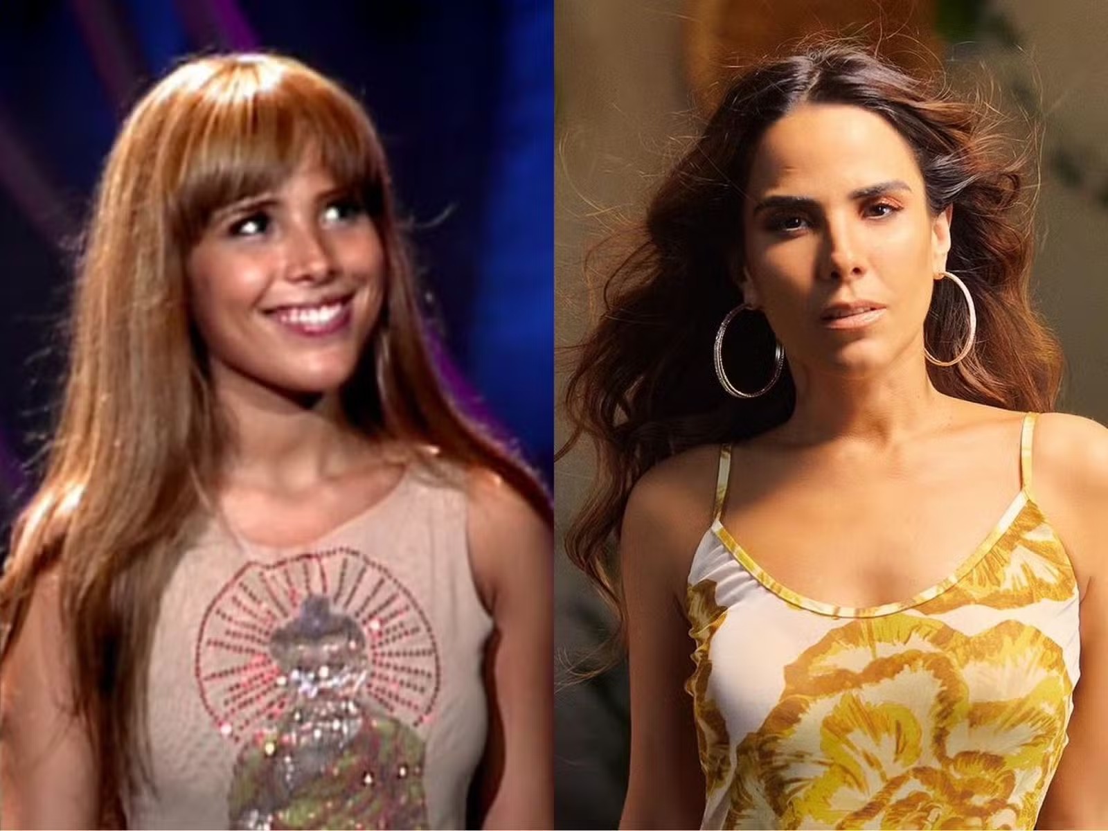 4 de 7 Vanessa na gravação do seu primeiro DVD em 2003 e hoje. A cantora revelou que fez plástica no nariz aos 15 anos e que aplica botox, principalmente na testa — Foto: Reprodução