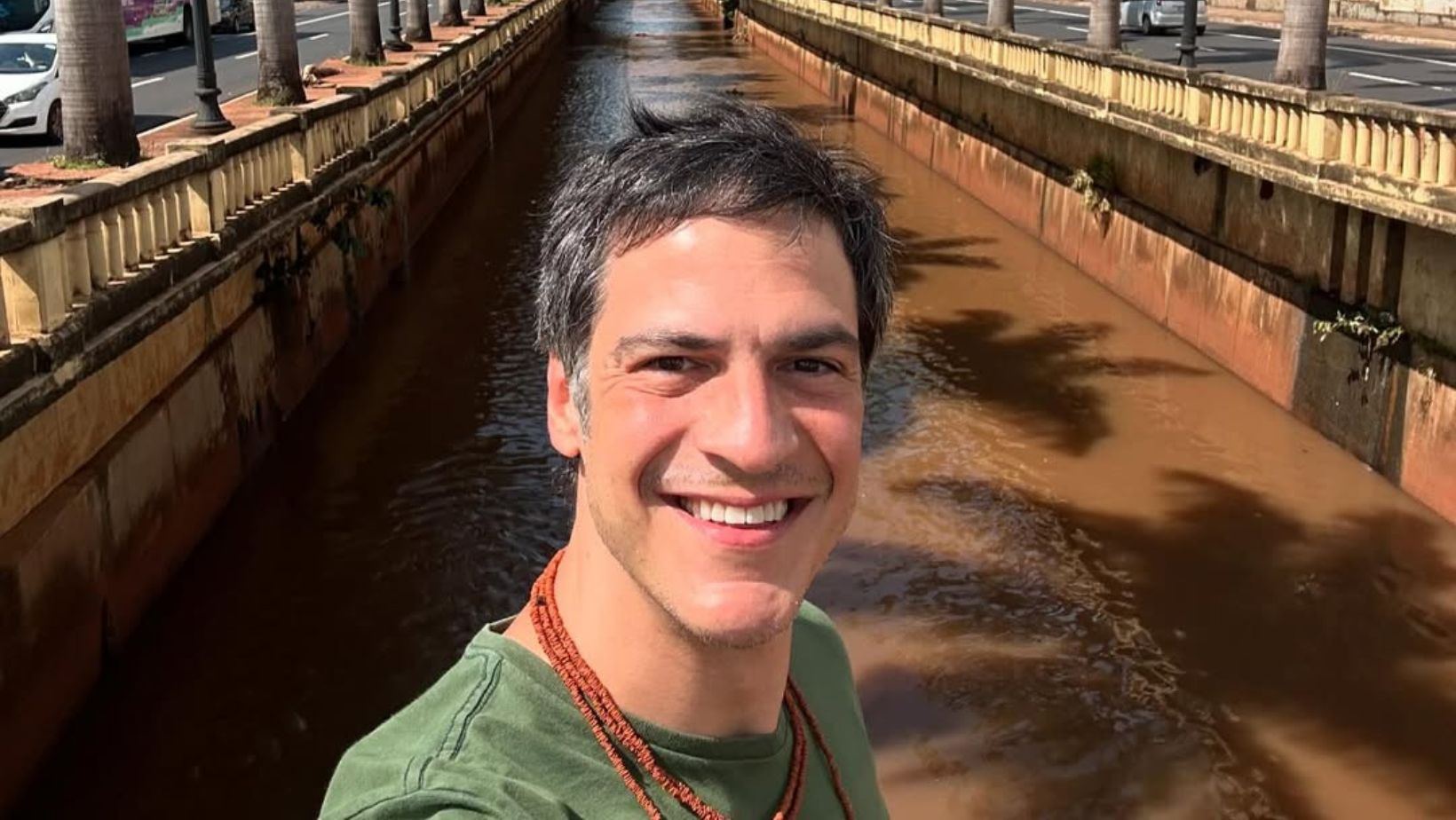 “Ridículo tentar esconder”, dispara Mateus Solano após assumir calvice