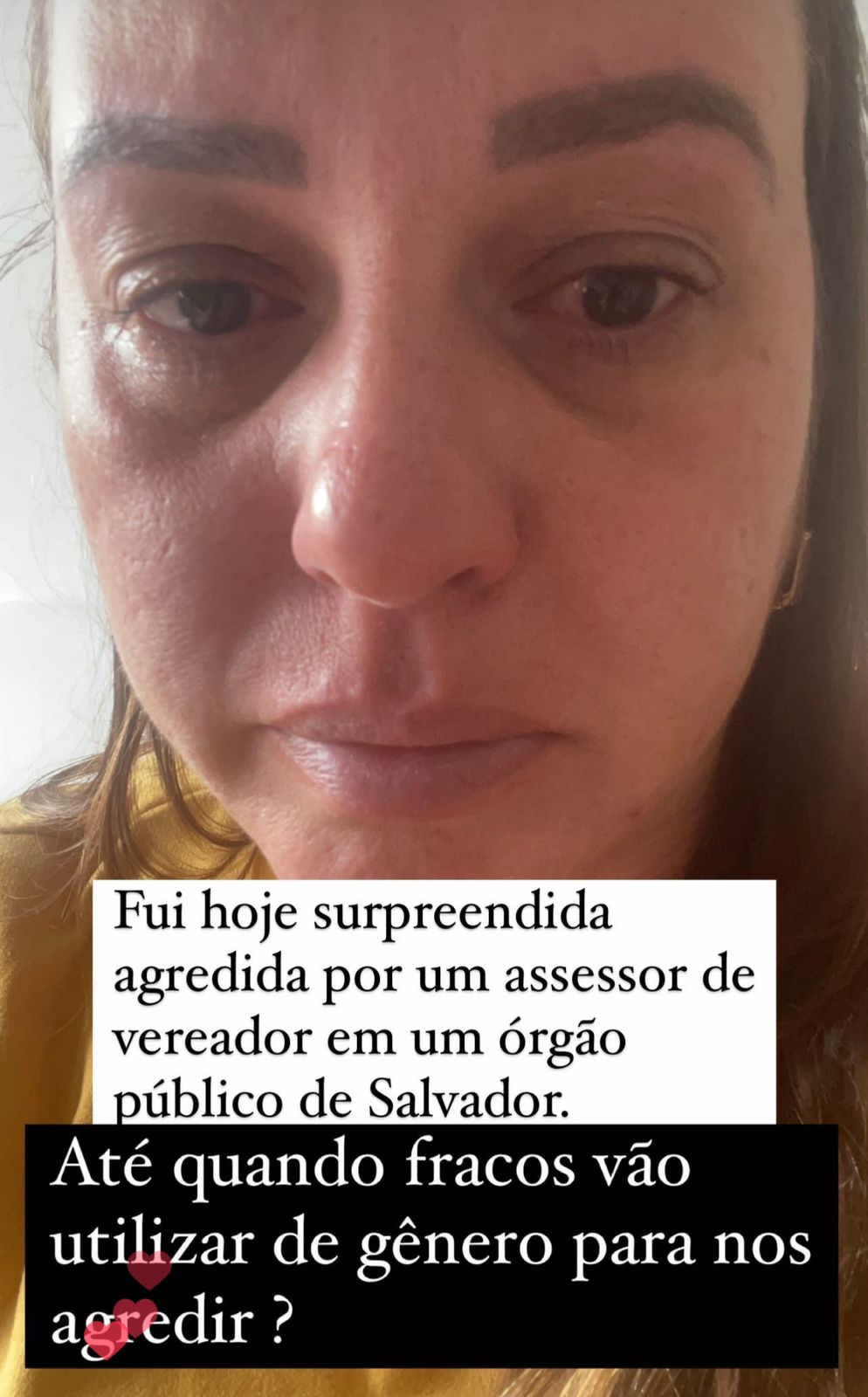 vítima agressão sedur