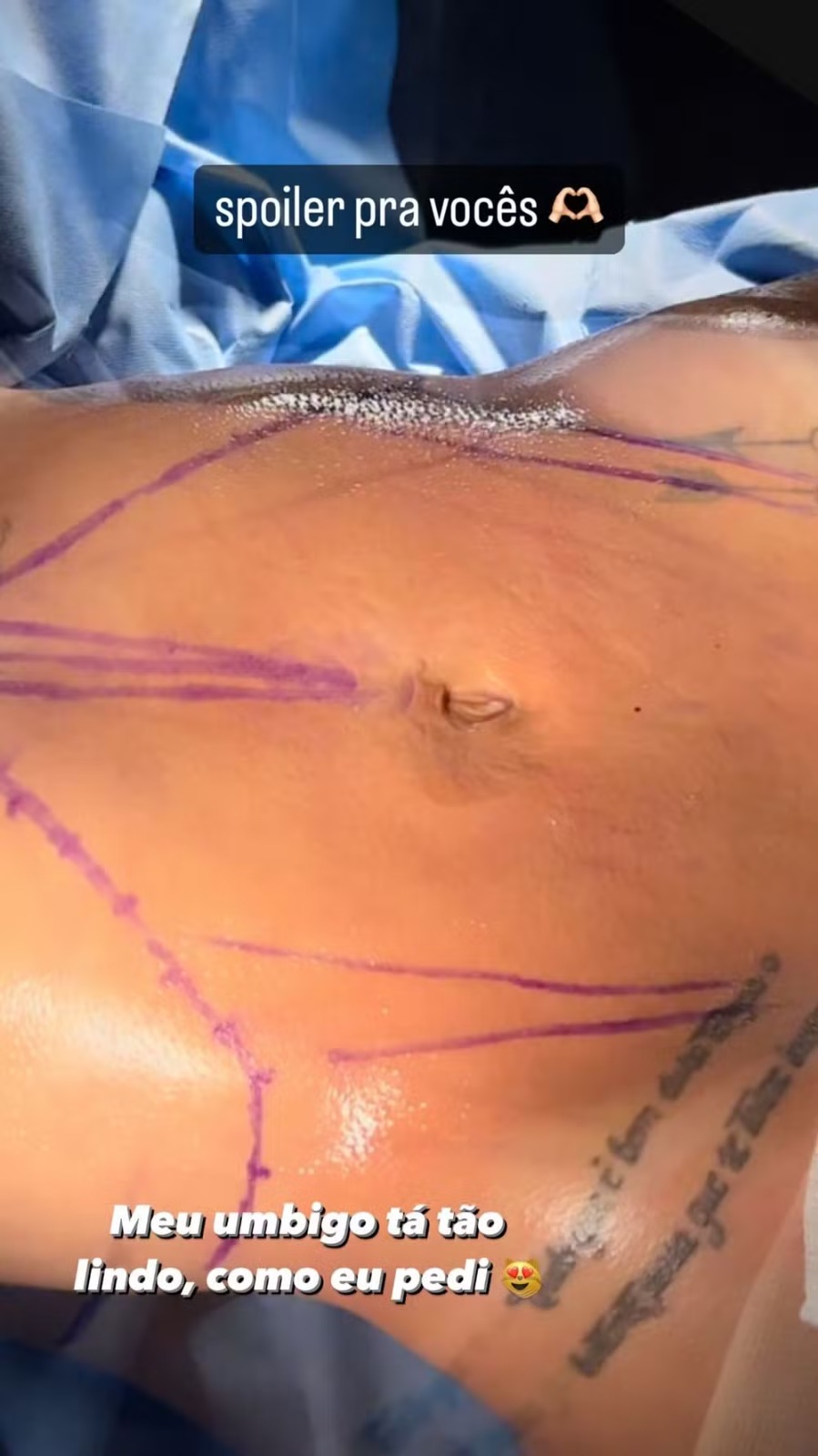 mirella