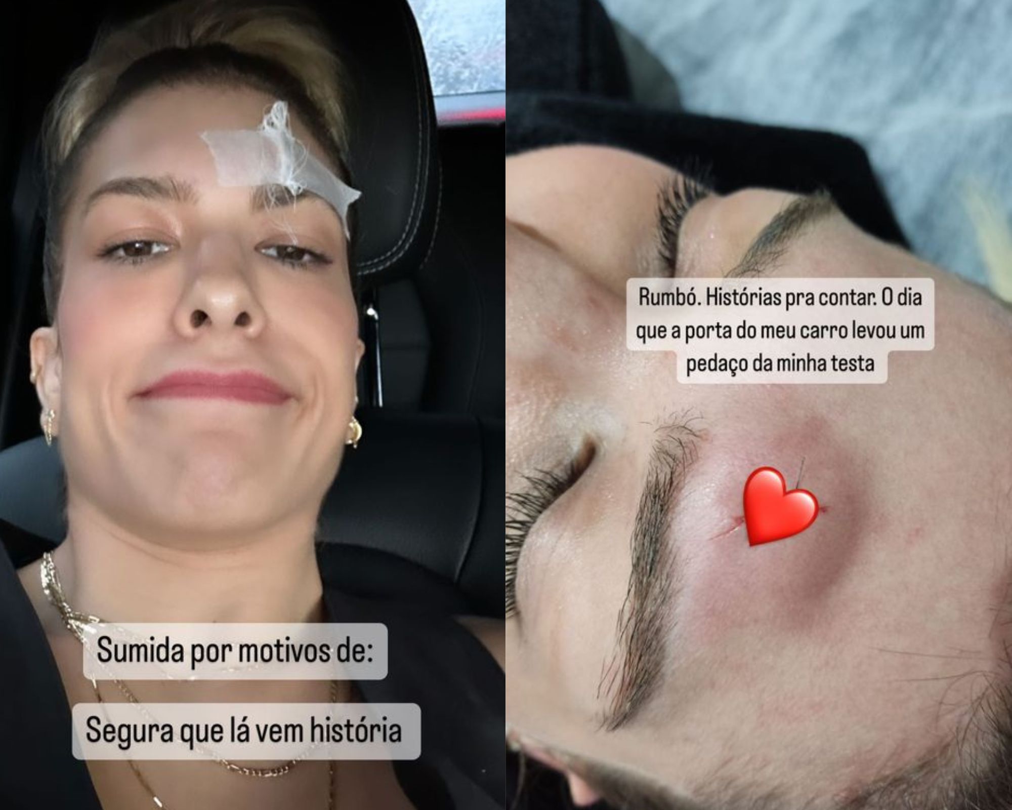 lore improta