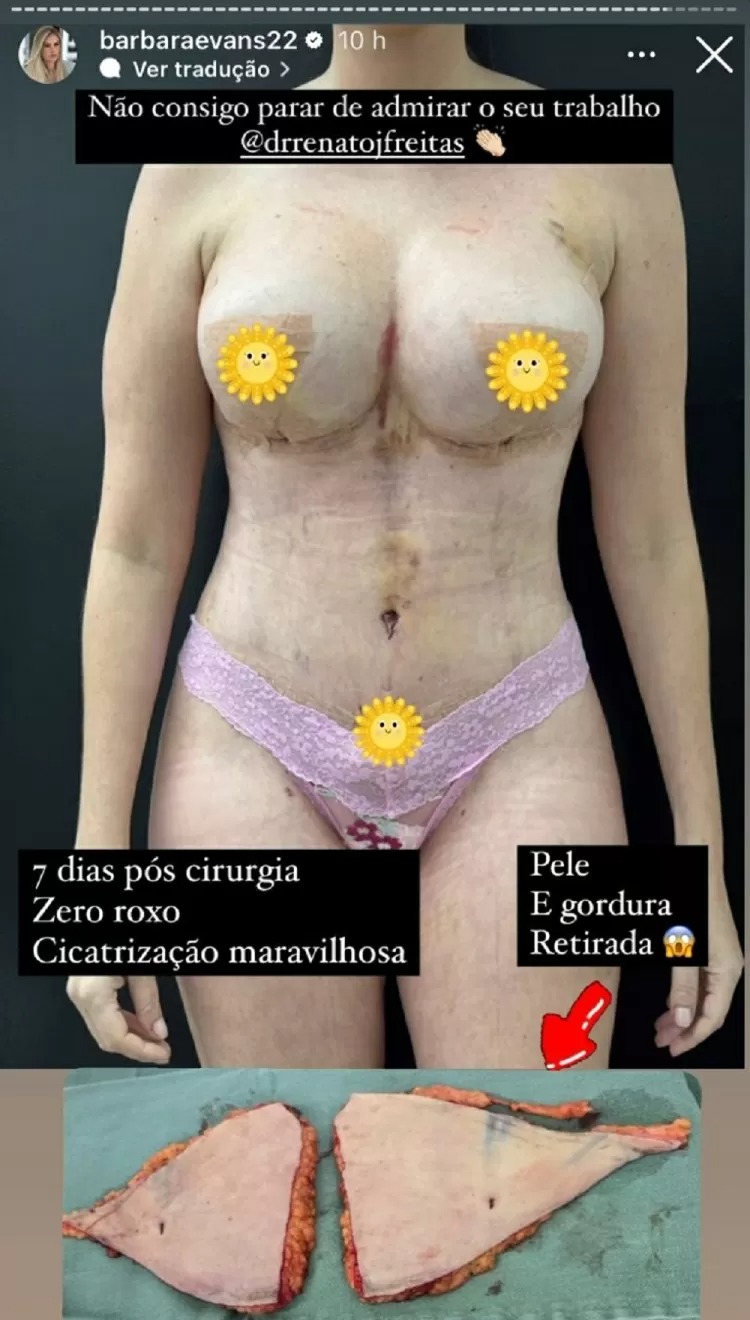 barbara