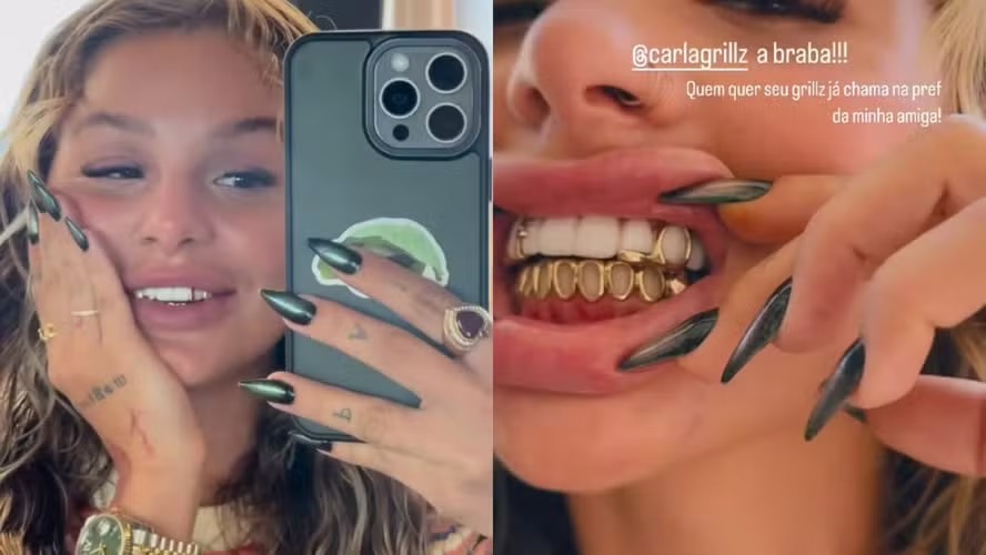 joias nos dente