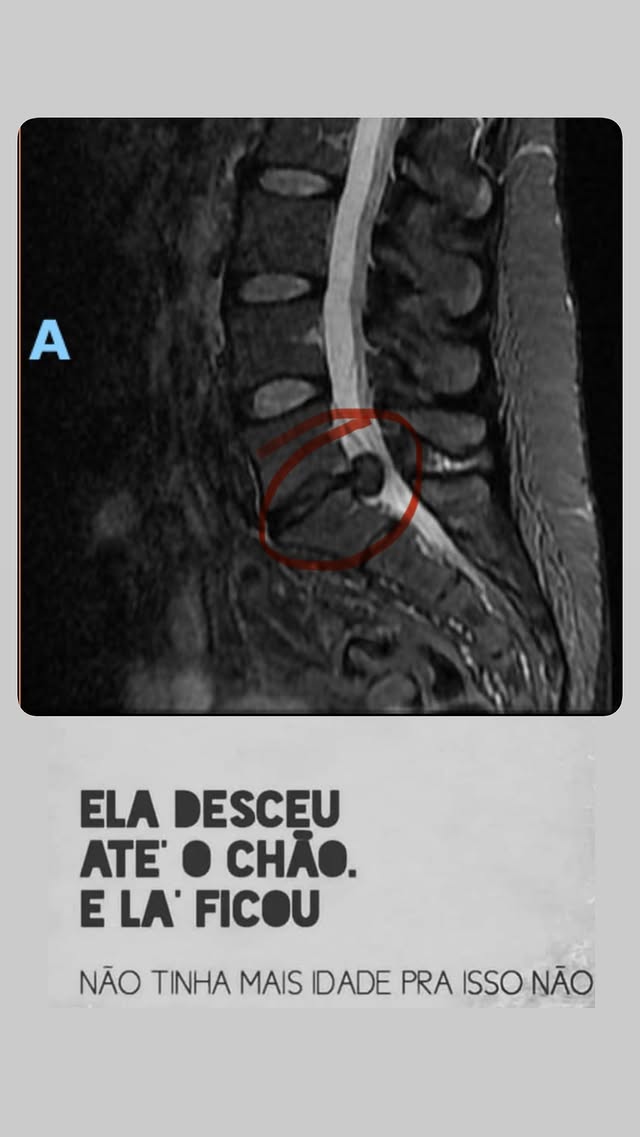 print