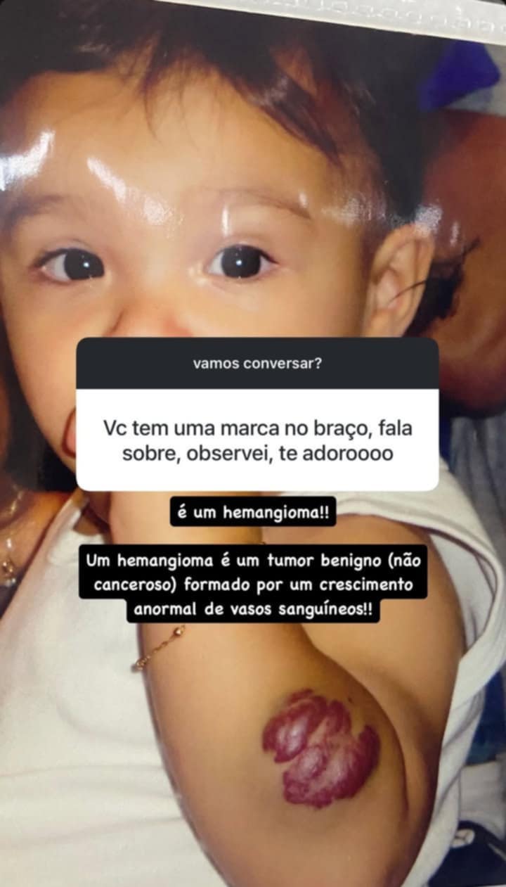 story de duda guerra