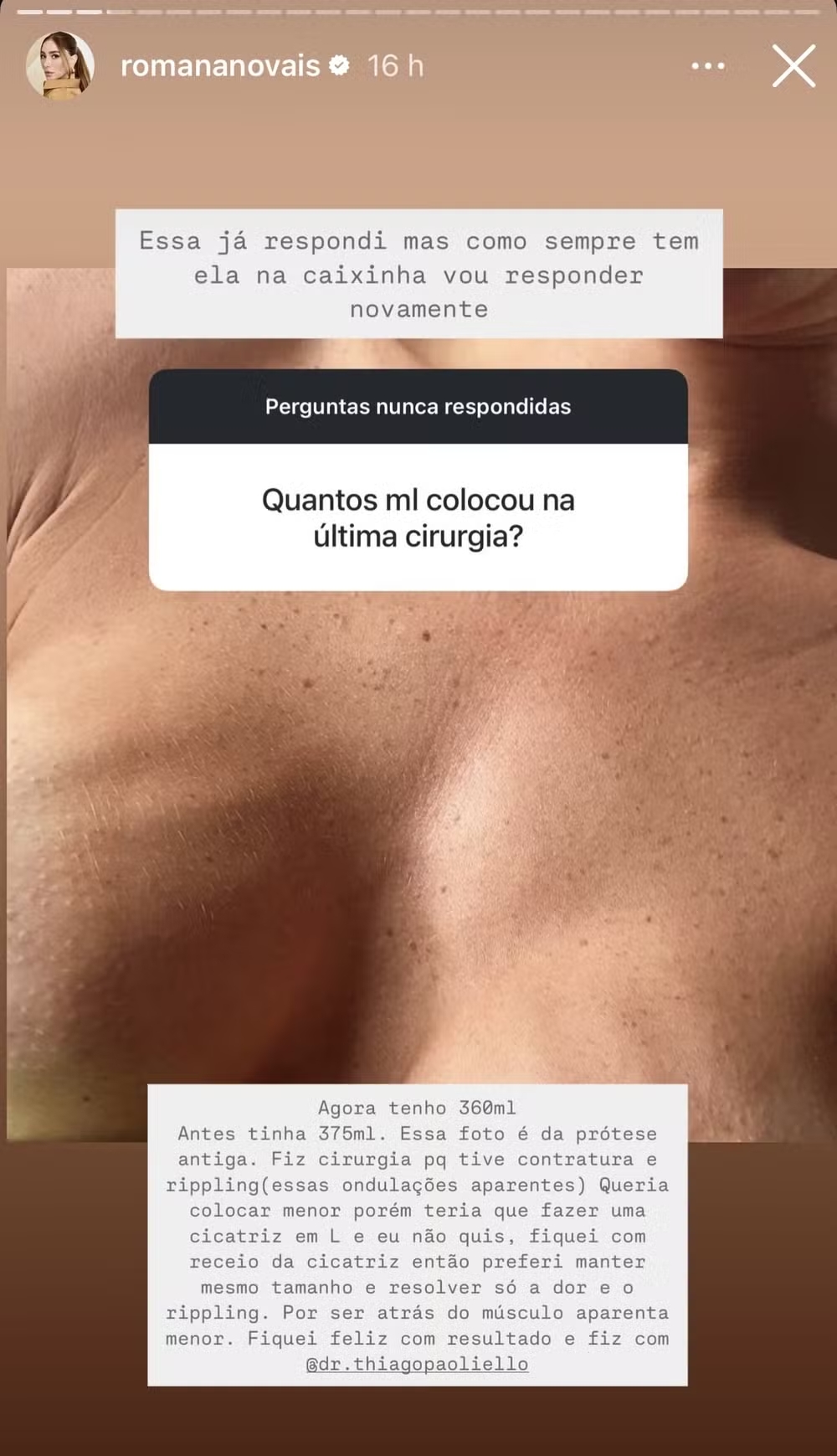 story de Romana