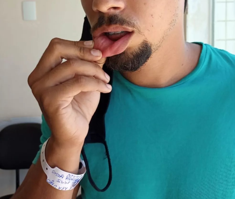 agressão