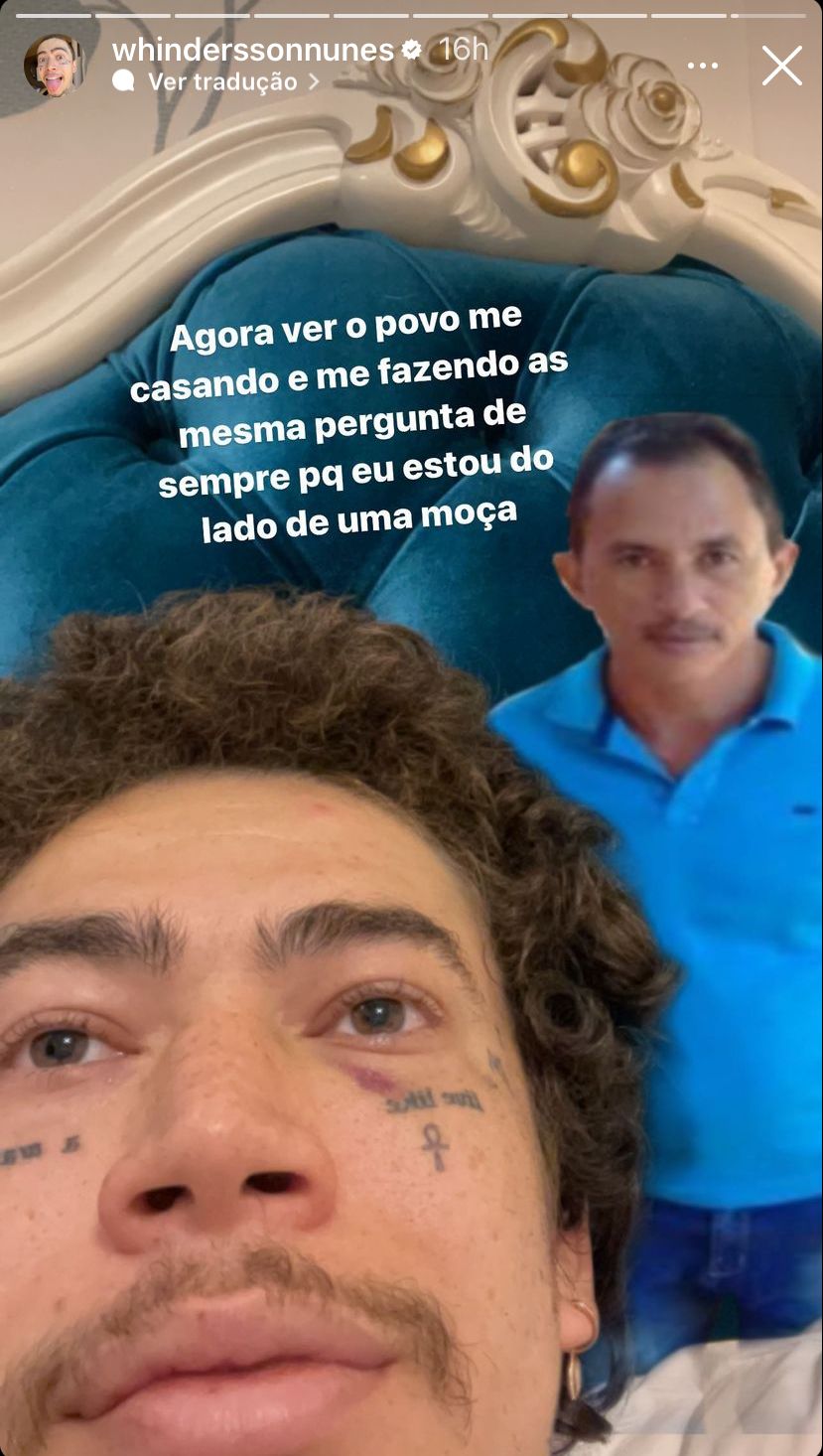 whindersson