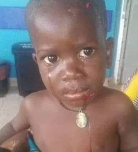 A criança teve metade do corpo engolido antes do hipopótamo cuspir, após ser atingido por pedras