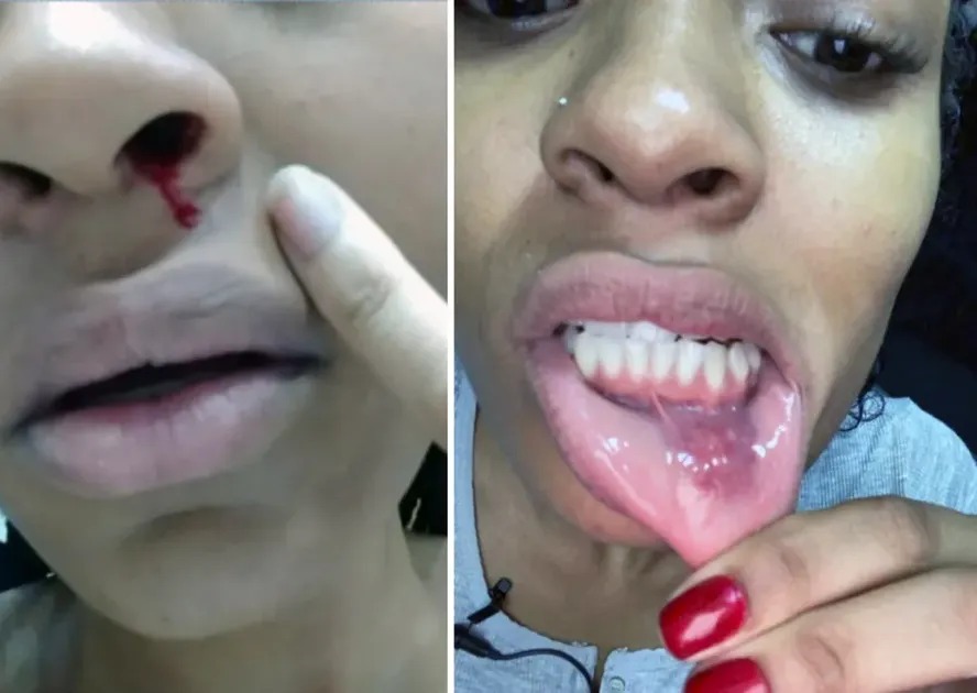 patrícia