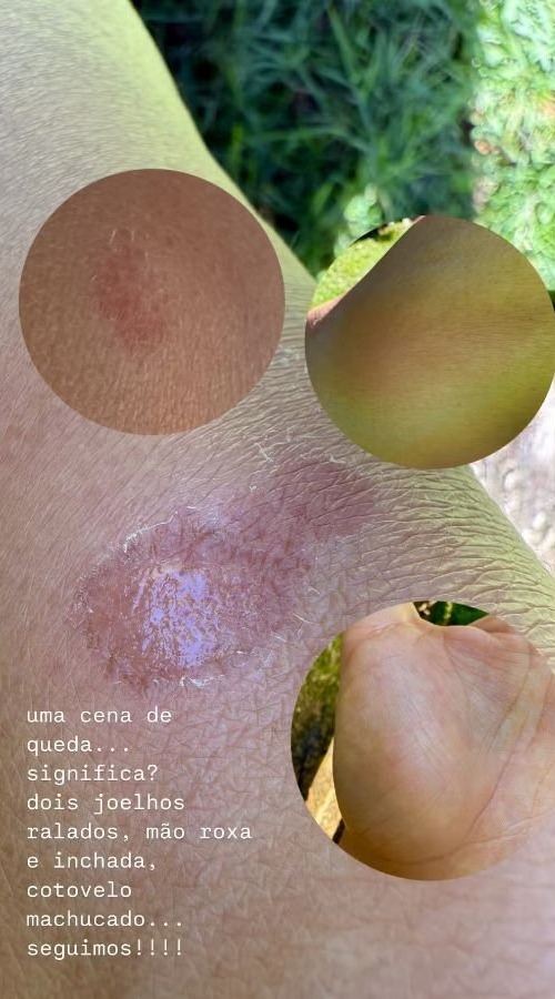 saúde