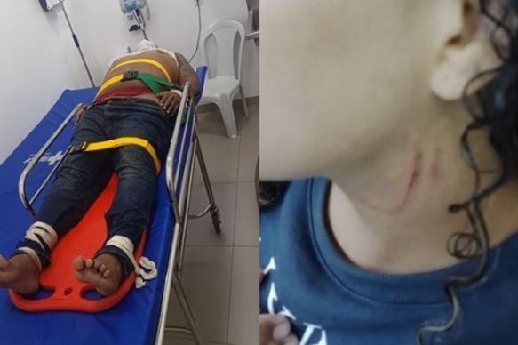 Vítima arranhada e homem na UPA