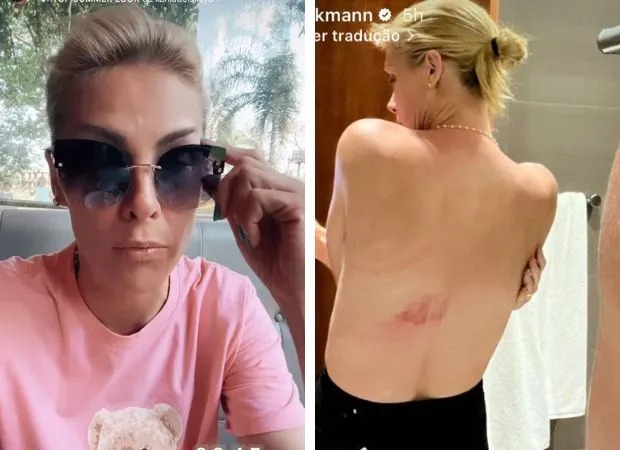 ana-hickmann