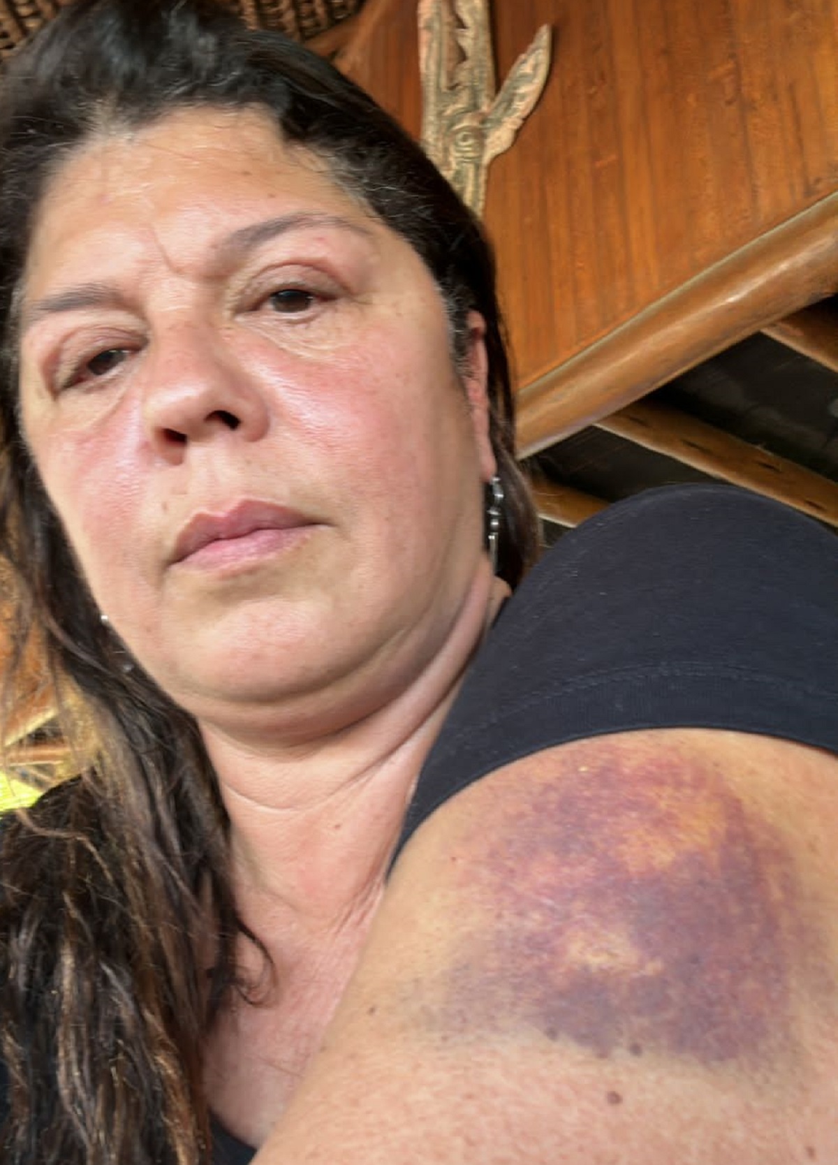 Imagem da dona do hotel mostrando que também foi agredida na confusão