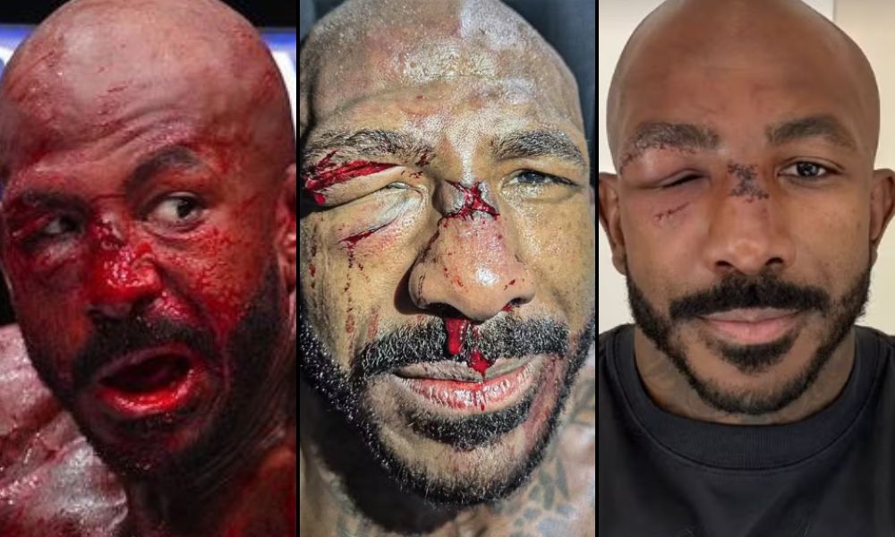 Rosto do lutador Khalil Rountree durante e após a luta com o brasileiro Alex "Poatan" Pereira