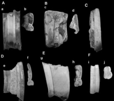 Dente com hipoplasia