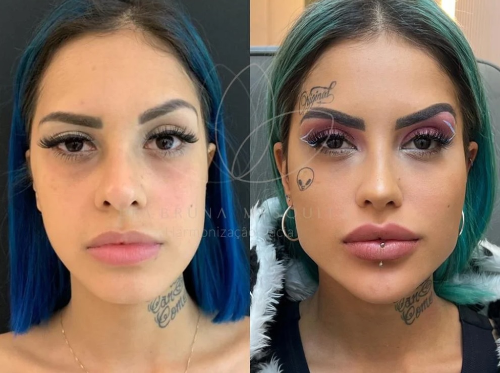 A Fazenda Tati Zaqui Gasta Cach Do Reality Em Procedimentos Saiba A Fazenda Tati Zaqui Gasta Cach Do Reality Em Procedimentos Saiba