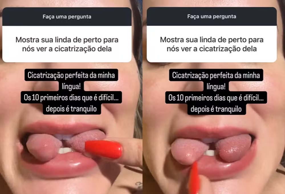 andressa