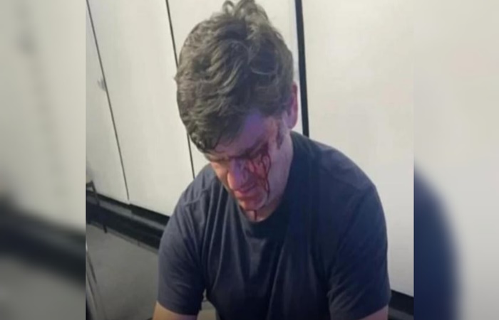 O marqueteiro Duda Lima levou seis pontos no rosto. Foto: Reprodução