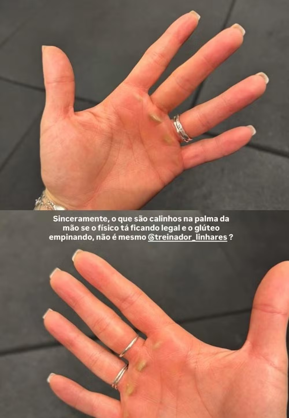 Ex-BBB Giovanna Lima mostra mão com calos após treino — Foto: Reprodução/Instagram