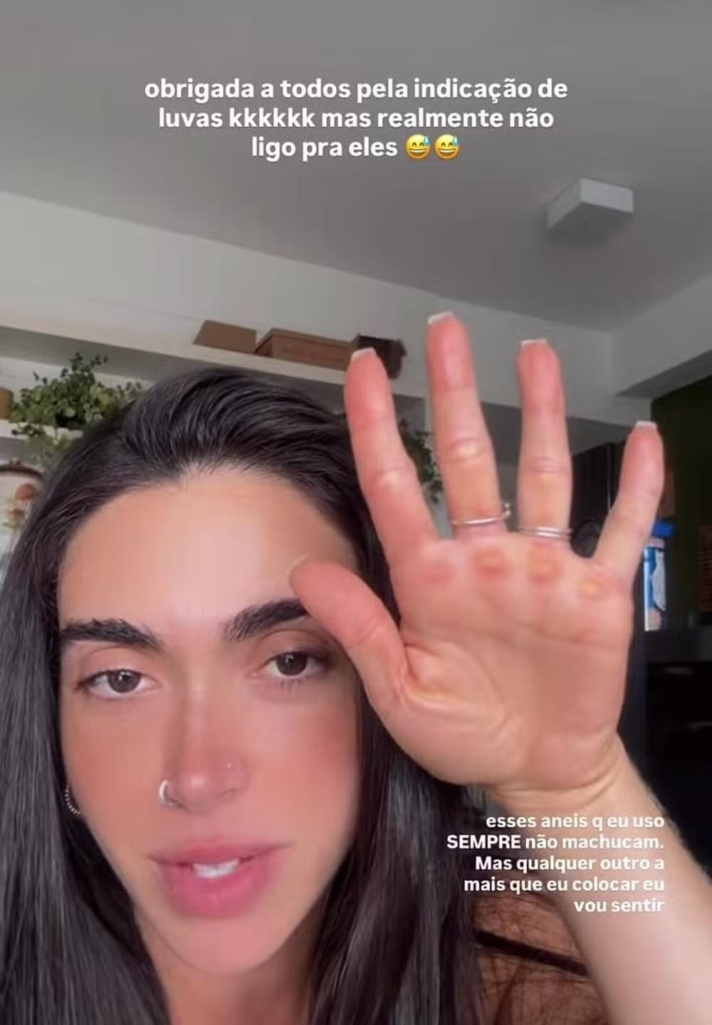 Ex-BBB Giovanna Lima mostra mão com calos após treino — Foto: Reprodução/Instagram